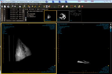 prc direct inteleviewer.